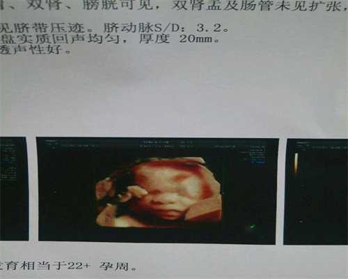 郑州试管婴儿的精子从哪里来,郑州华大国际助孕